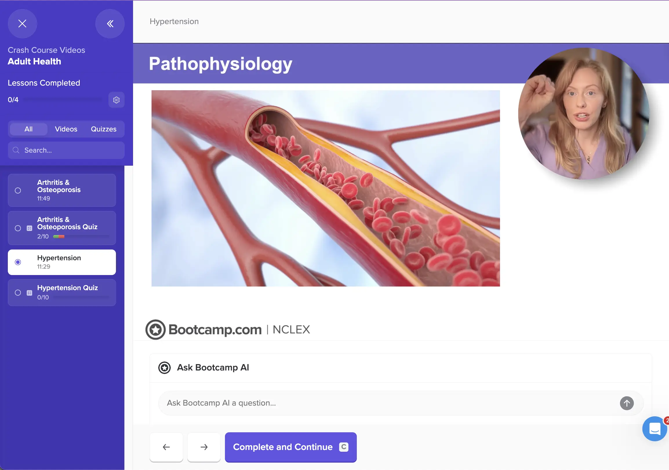NCLEX Bootcamp Crash Course video lesson on Hypertension pathophysiology with instructor walkthrough